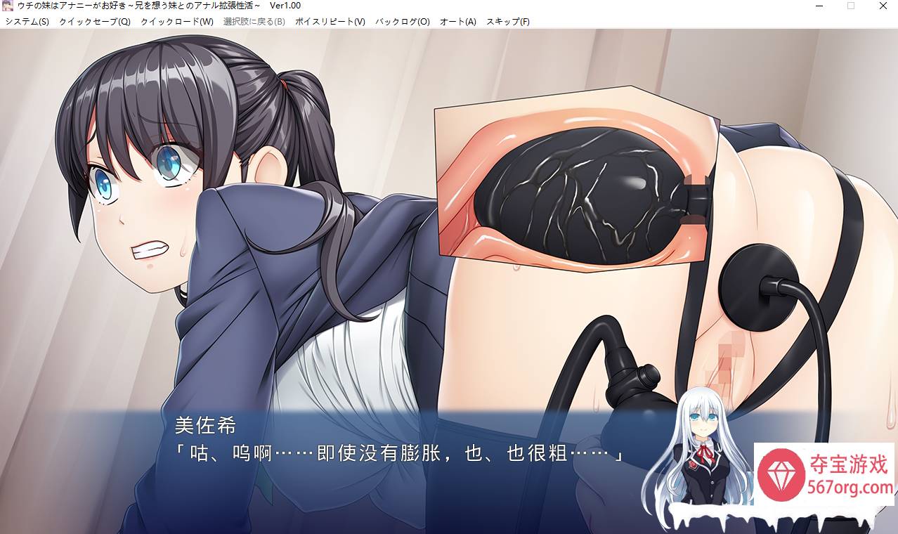 [ADV汉化]我的妹妹喜欢自慰 ～兄妹之间的肛门扩张性爱～AI汉化版+全CG存档[百度460M盘]